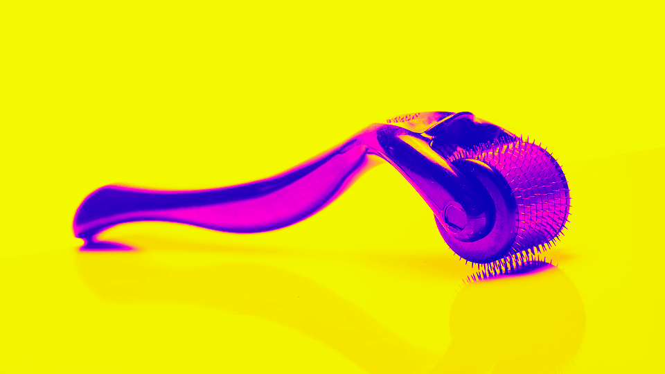 Dermaroller microneedling