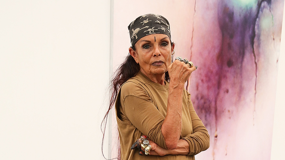 The Weird Upside of Acne: Turns Out You'll Age Better