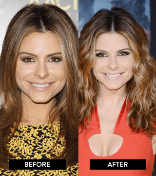 Everything You Need to Know Before Getting Highlights for Hair