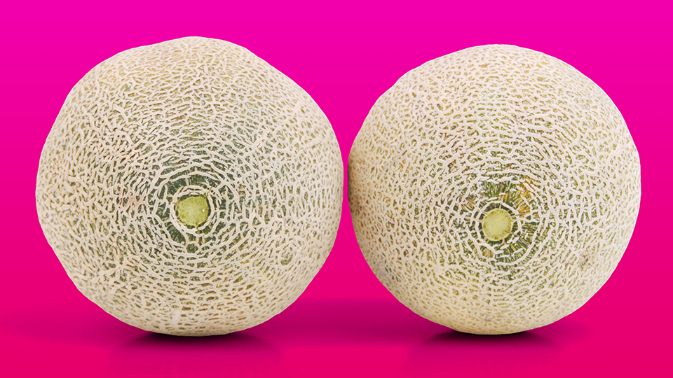 5 Millennial Women on Why They Had Plastic Surgery