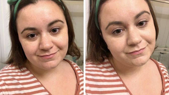 flesh before and after