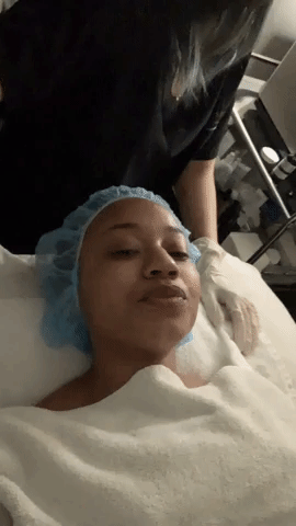 pca-chemical-peel-review