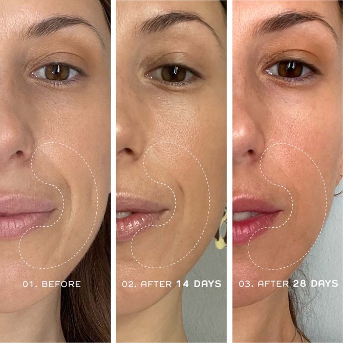 Ren Skincare’s Bio-Retinoid Youth Serum