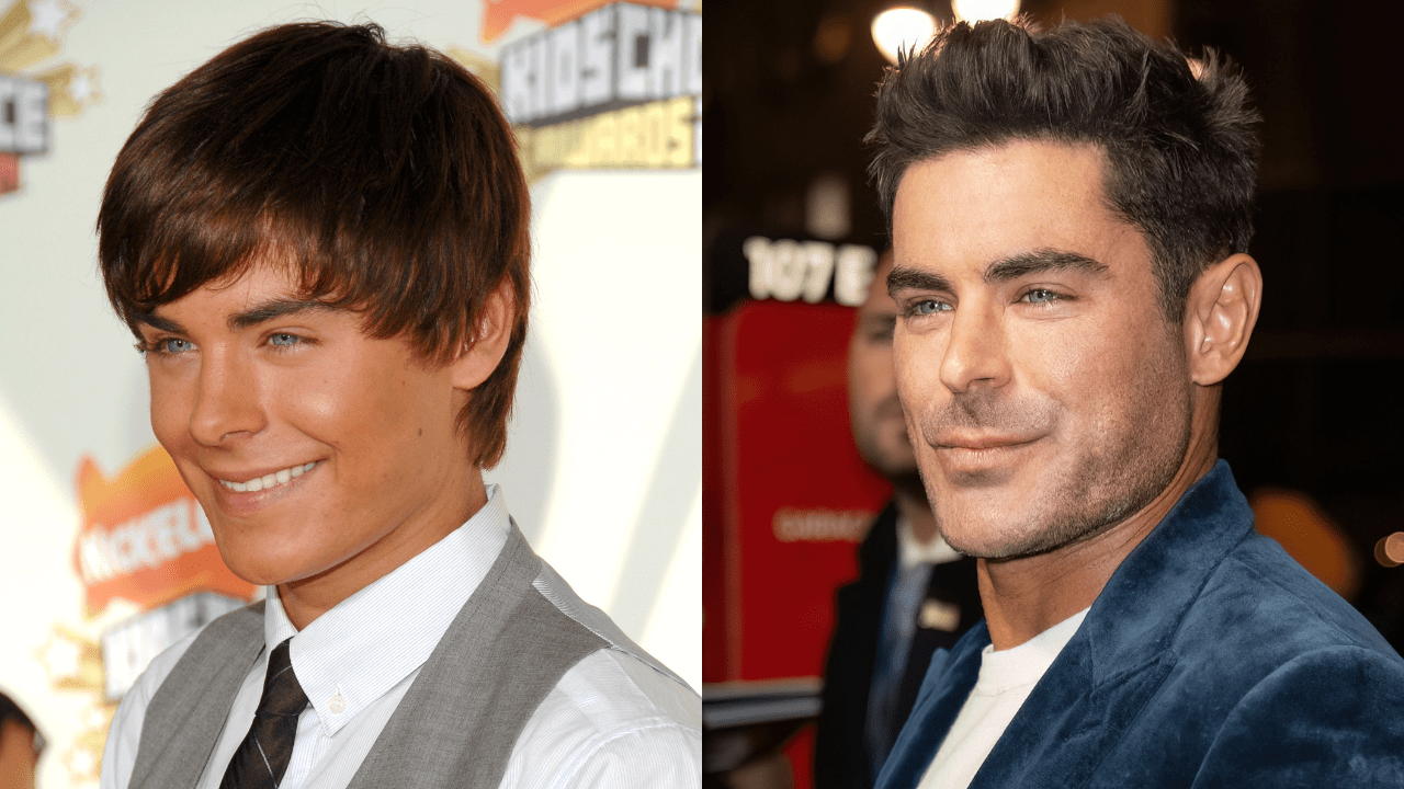 What happened to Zac Efron's face?