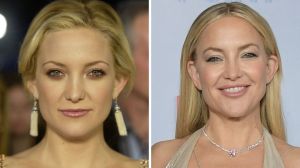Kate Hudson Surgery