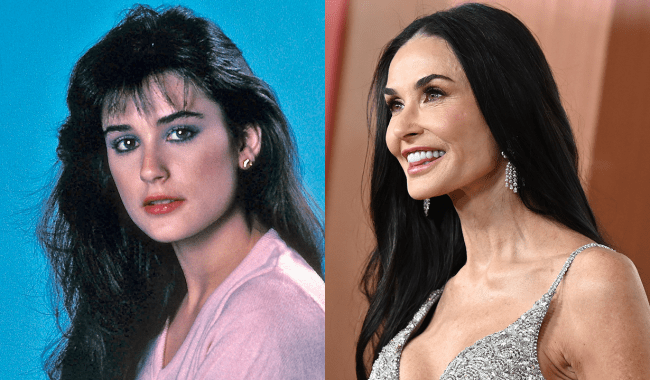 Has Demi Moore Had Plastic Surgery